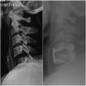 Spine Surgery Hospitals in Ahmedabad